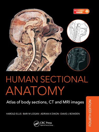 Human Sectional Anatomy Atlas Of Body Sections Ct And Mri Images 4th Edition David J Bowden Harold Ellis Adrian K Dixon B M Logan