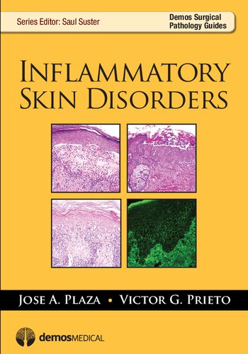 Inflammatory Skin Disorders Jose A Plaza Md Victor G Prieto
