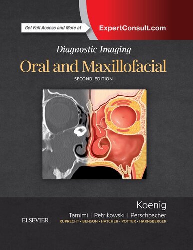 Diagnostic Imaging Oral And Maxillofacial 2nd Edition Lisa J Koenig