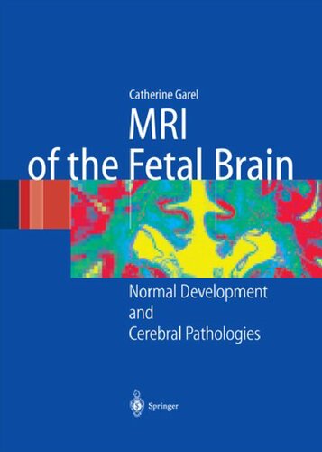 Mri Of The Fetal Brain Normal Development And Cerebral Pathologies C Garel