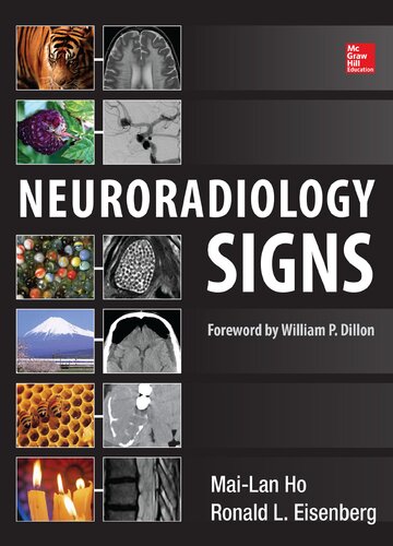 Neuroradiology Signs Mailan Ho Ronald L Eisenberg