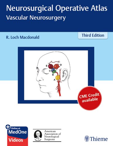 Neurosurgical Operative Atlas Vascular Neurosurgery 3rd Edition Robert Loch Macdonald Editor