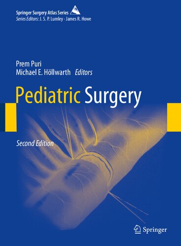 Pediatric Surgery 2nd Edition Prem Puri Michael E Hllwarth