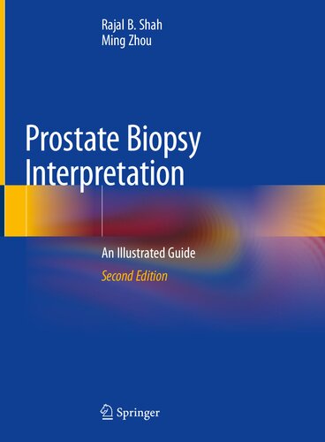 Prostate Biopsy Interpretation An Illustrated Guide 2nd Edition Rajal B Shah