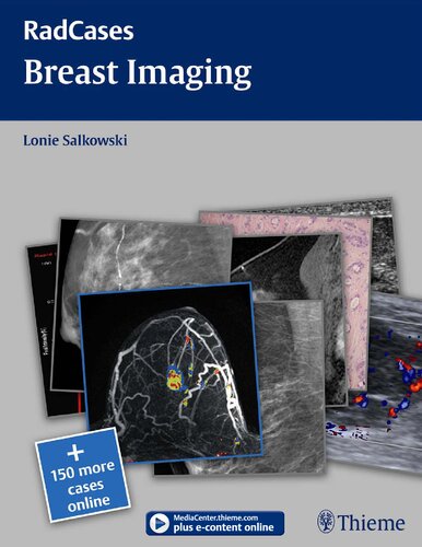 Radcases Breast Imaging Lonie Salkowski Jonathan Lorenz Hedor Ferrai
