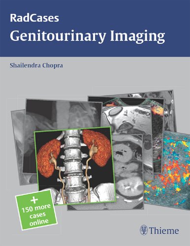 Genitourinary Imaging Shailendra Chopra