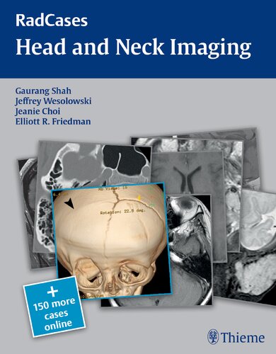 Head And Neck Imaging Gaurang Shah Jeffrey Robert Wesolowski