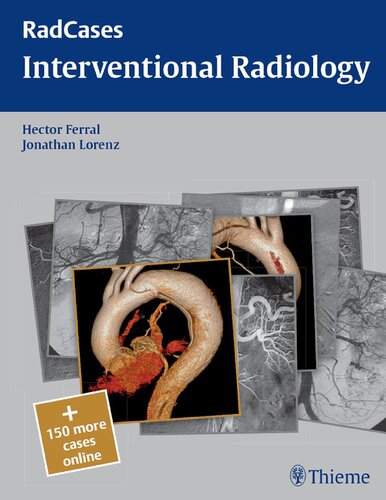 Interventional Radiology Jonathan Lorenz Hector Ferral