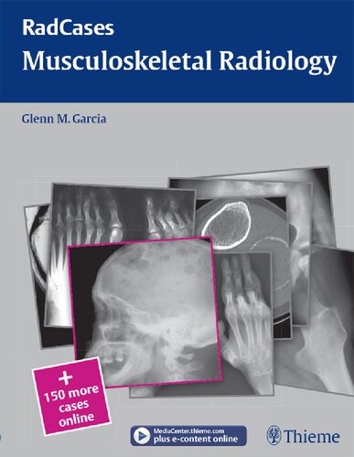 Musculoskeletal Radiology Glenn M Garcia