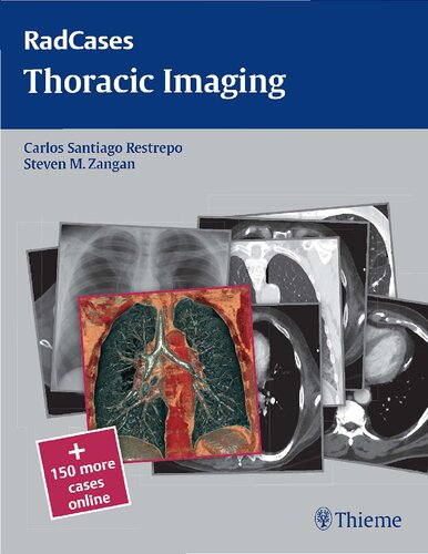 Thoracic Imaging Carlos Santiago Restrepo Steven M Zangan