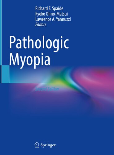 Pathologic Myopia 2nd Edition Richard F Spaide Kyoko Ohnomatsui