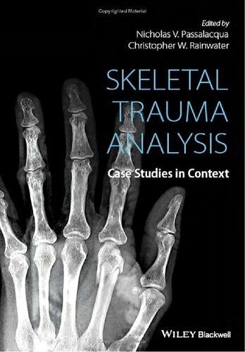 Skeletal Trauma Analysis Case Studies In Context Nicholas V Passalacqua Editor Christopher W Rainwater Editor