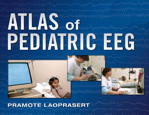 Atlas Of Pediatric Eeg Pramote Laoprasert