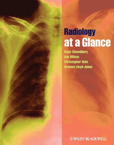 Radiology At A Glance Rajat Chowdhury Iain D C Wilson Christopher J Rofe