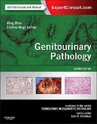 Genitourinary Pathology 2nd Edition Ming Zhou Cristina Magigalluzzi