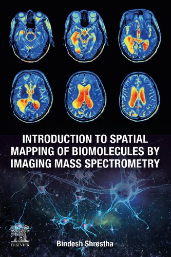 Introduction To Spatial Mapping Of Biomolecules By Imaging Mass Spectrometry Bindesh Shrestha