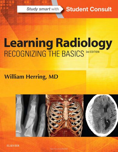 Learning Radiology Recognizing The Basics 3rd Edition William Herring