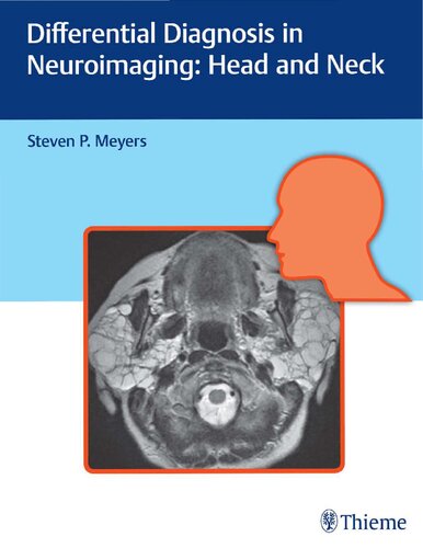 Differential Diagnosis In Neuroimaging Head And Neck Steven P Meyers