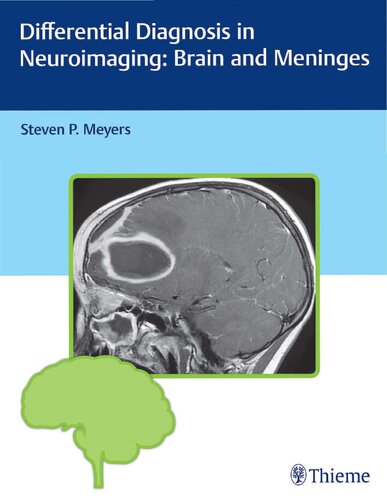 Differential Diagnosis In Neuroimaging Brain And Meninges Steven P Meyers