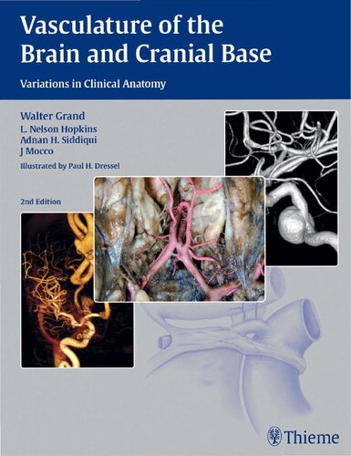 Vasculature Of The Brain And Cranial Base Variations In Clinical Anatomy 2nd Edition Adnan H Siddiqui L N Hopkins Walter Grand J Mocco