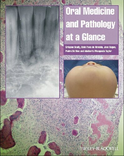 Oral Medicine At A Glance Crispian Scully Oslei Paes De Almeida