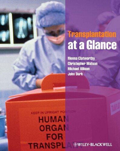 Transplantation At A Glance Menna Clatworthy Christopher Watson