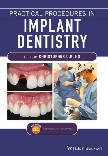 Practical Procedures In Implant Dentistry 1st Edition Christopher C K Ho Editor