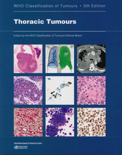 Thoracic Tumours Who Classification Of Tumours 5th Edition Who Classification Of Tumours Editorial Board Editor