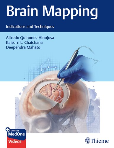 Brain Mapping Indications And Techniques 1st Edition Alfredo Quinoneshinojosa