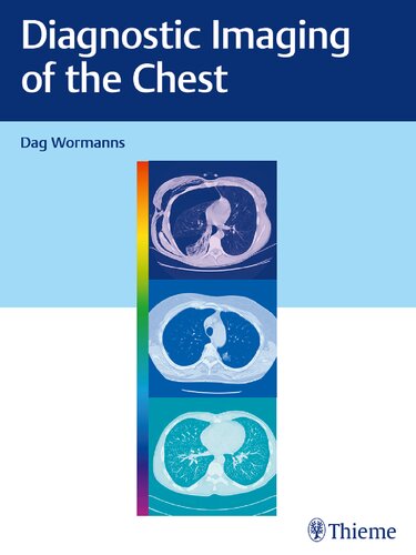 Diagnostic Imaging Of The Chest 1st Edition Dag Wormanns Editor