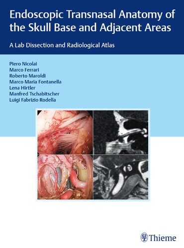 Endoscopic Transnasal Anatomy Of The Skull Base And Adjacent Areas A Lab Dissection And Radiological Atlas 1st Edition Marco Ferrari Roberto Maroldi Marco Maria Fontanella Lena Hirtler Manfred Tschabitscher Luigi Fabrizio Rodella