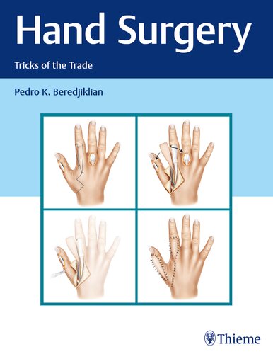 Hand Surgery Tricks Of The Trade Illustrated Pedro Beredjiklian