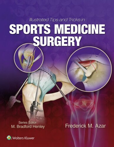 Illustrated Tips And Tricks In Sports Medicine Surgery Frederick Azar