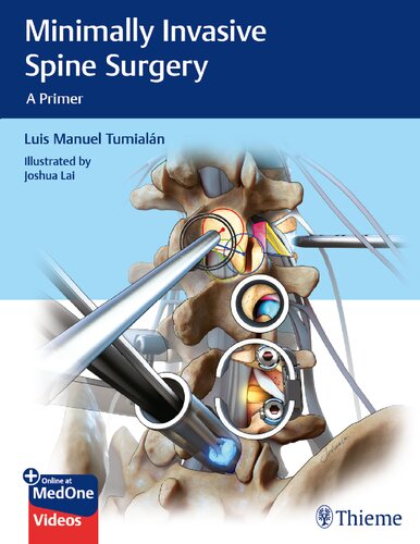Minimally Invasive Spine Surgery A Primer Illustrated Luis M Tumialan