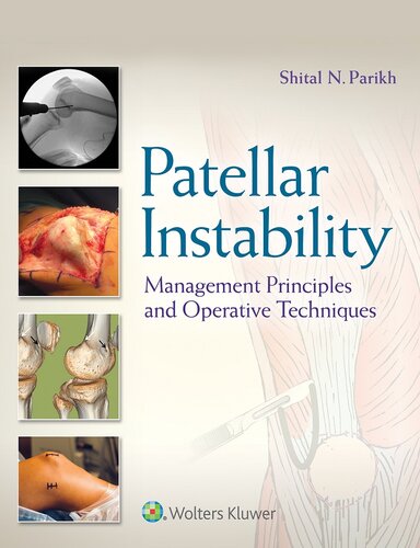 Patellar Instability Management Principles And Operative Techniques 1st Edition Dr Shital N Parikh Md Editor