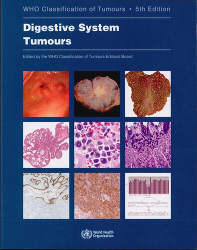 Digestive System Tumours Who Classification Of Tumours 5th Edition Who Classification Of Tumours Editorial Board