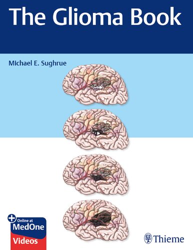 The Glioma Book 1st Edition Michael E Sughrue