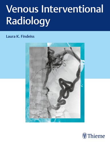 Venous Interventional Radiology 1st Edition Laura Findeiss