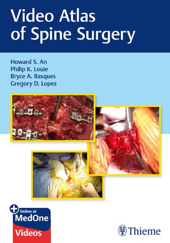 Video Atlas Of Spine Surgery Illustrated Howard S An Philip K Louie