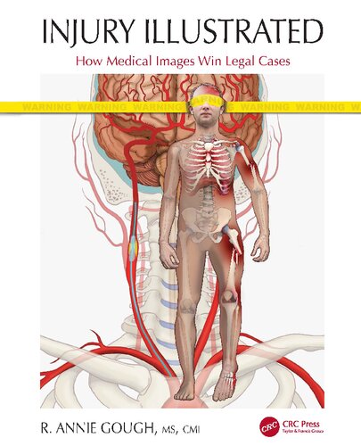 Injury Illustrated How Medical Images Win Legal Cases R Annie Gough
