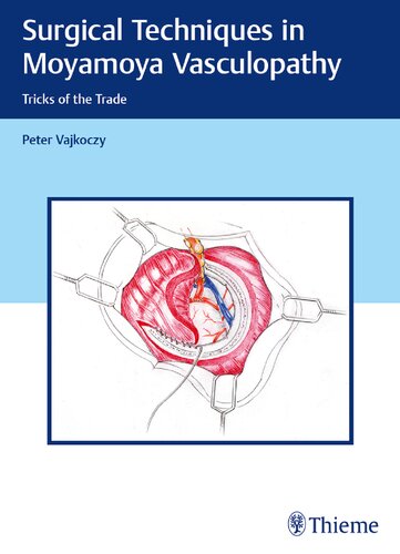 Surgical Techniques In Moyamoya Vasculopathy Tricks Of The Trade 1st Edition Peter Vajkoczy