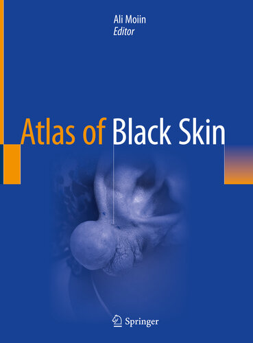 Atlas Of Black Skin 1st Ed 2020 Ali Moiin Editor