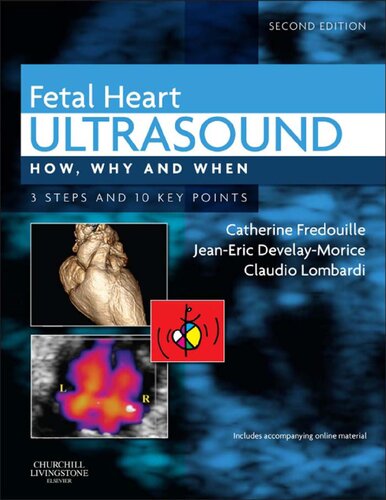 Fetal Heart Ultrasound 2nd Edition Catherine Fredouille Jeaneric Develaymorice