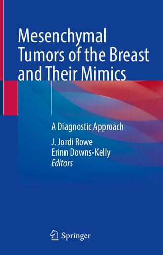 Mesenchymal Tumors Of The Breast And Their Mimics A Diagnostic Approach J Jordi Rowe