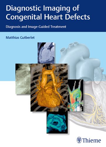 Diagnostic Imaging Of Congenital Heart Defects Diagnosis And Imageguided Treatment Matthias Gutberlet