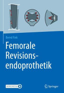Femorale Revisionsendoprothetik German Edition 1 Aufl 2021 Fink