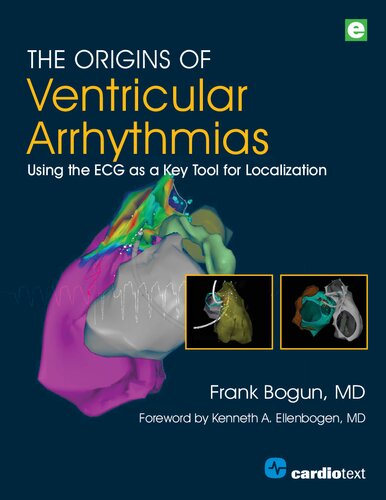 The Origins Of Ventricular Arrhythmias Using The Ecg As A Key Tool For Localization 1st Edition Frank M Bogun