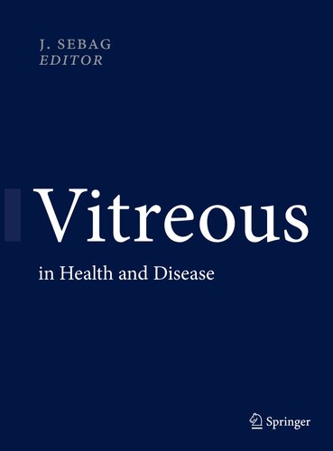 Vitreous In Health And Disease J Sebag Ed