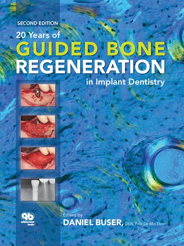 20 Years Of Guided Bone Regeneration In Implant Dentistry 2nd Edition Daniel Buser