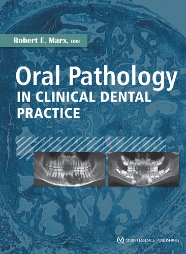 Oral Pathology In Clinical Dental Practice Illustrated Robert E Marx